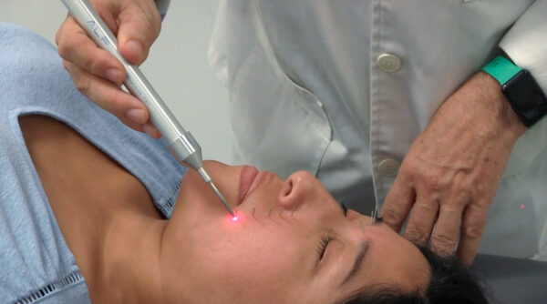 Lifting facial: Acupuntura, electropuntura y laserpuntura