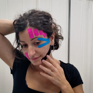 Kinesiotape aplicado a la estética