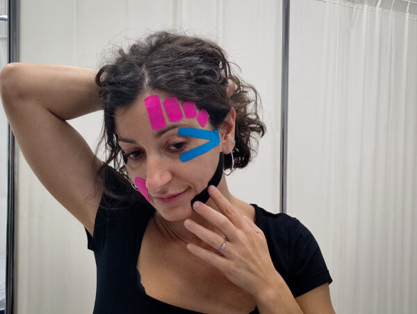 Kinesiotape aplicado a la estética